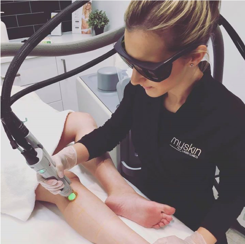 Laser Hair Removal Induction Training