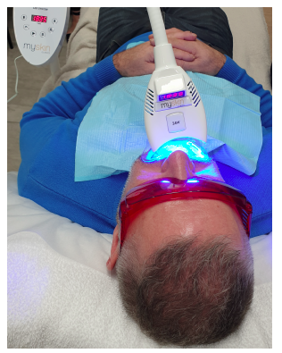 MySkin Clinics Teeth Whitening 